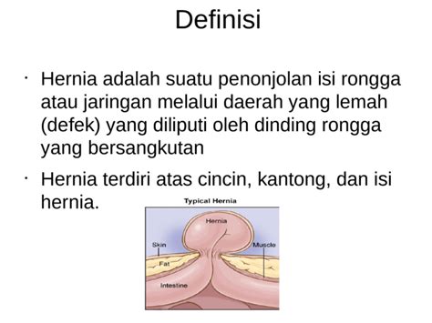 hernia inguinalis dextra adalah